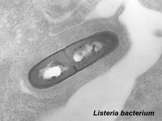 File:Listeria-bacterium.jpg
