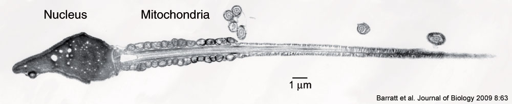 Human spermatozoa EM