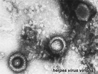 Herpes virus.jpg