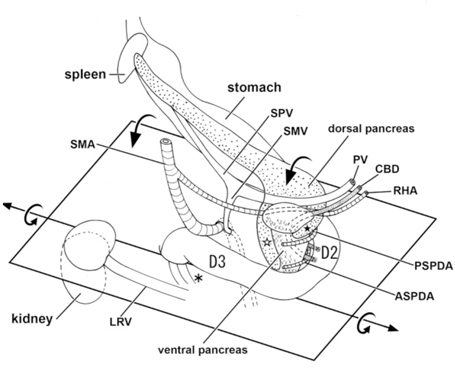 File:Human fetal pancreas anatomy cartoon.jpg