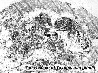 File:Toxoplasma tachyzoites.jpg