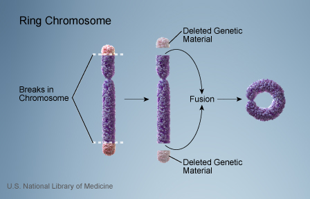 File:Chromosome- ring chromosome.jpg