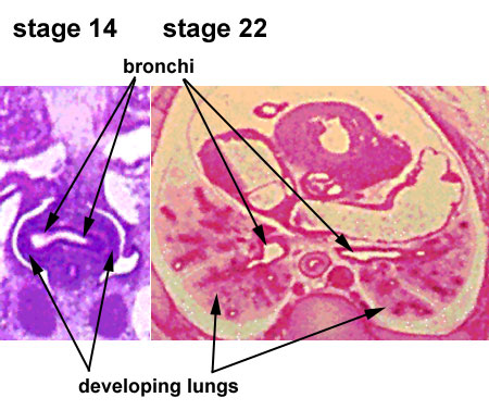 File:Stage14-22 lungs.jpg