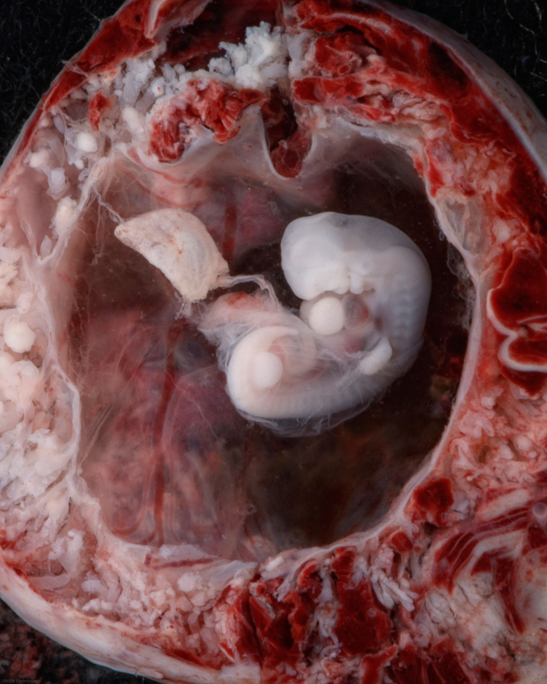 File:Stage14 bf18.jpg - Embryology
