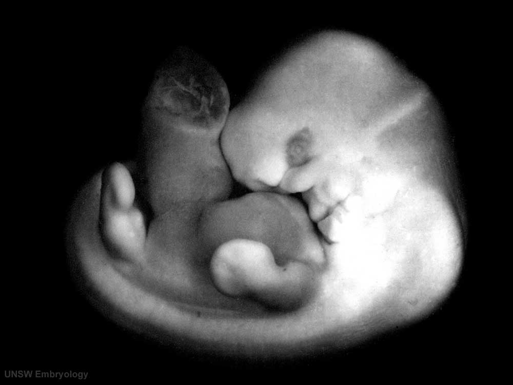 Zarodek, 8. tydzień ciąży, 6. tydzień życia zarodka