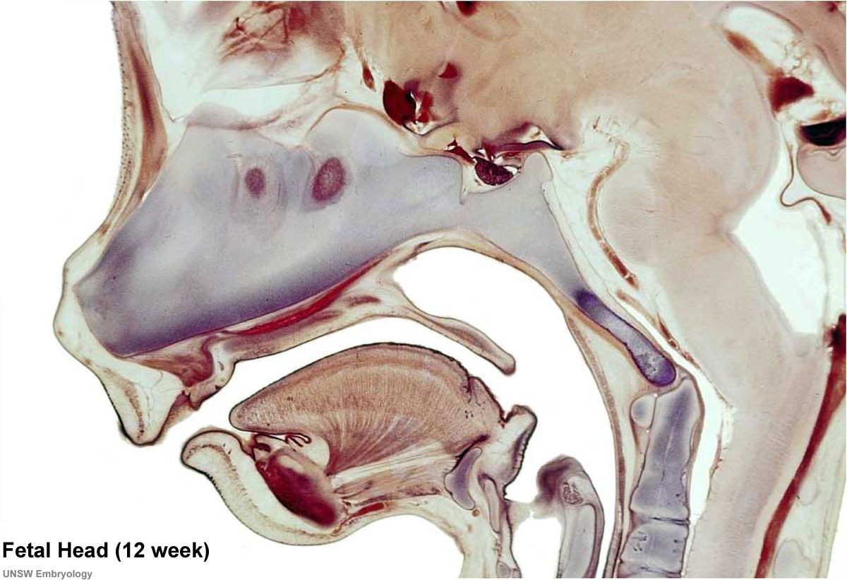 Fetal Head 12 weeks showing head structures and the brain