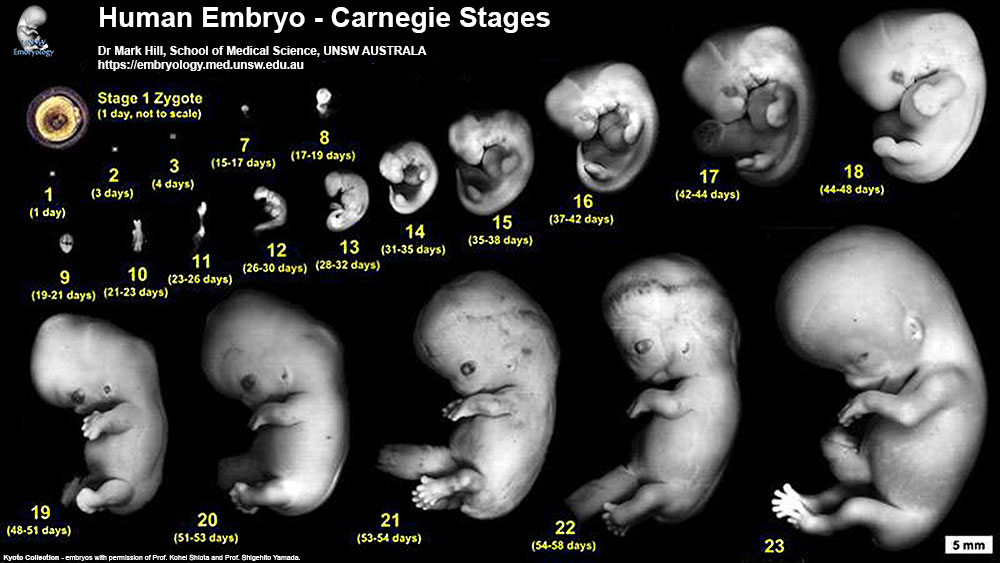 BGDA Lecture - Development of the Embryo/Fetus 2 - Embryology