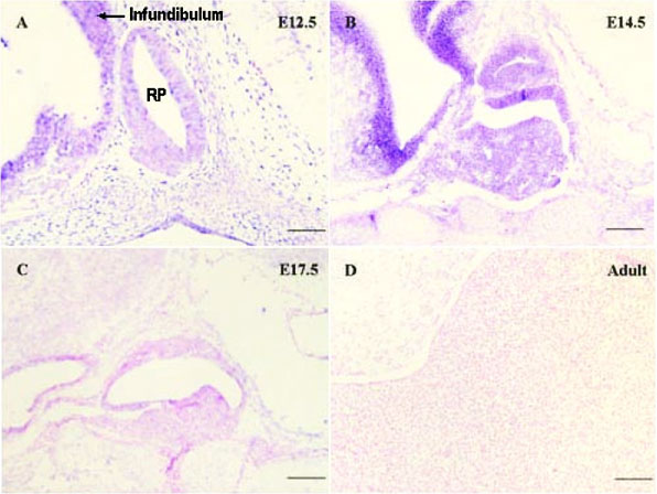 File:Mouse-pituitary Sox4 expression.jpg