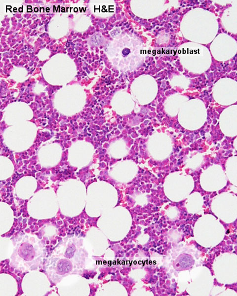 Megakaryocytes In Bone Marrow