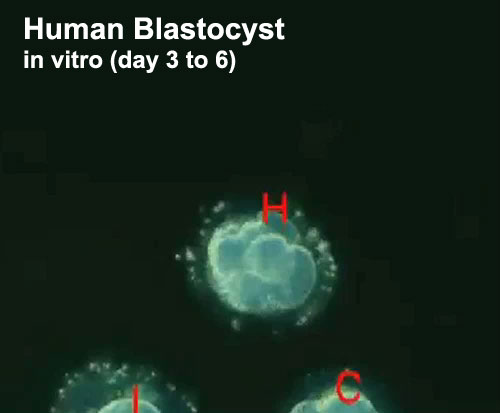 File:Human-blastocyst-day-3-6-icon.jpg
