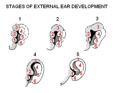 File:Devt of external ear.JPG