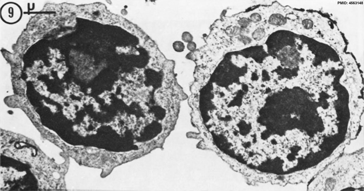 T and B lymphocytes (em)