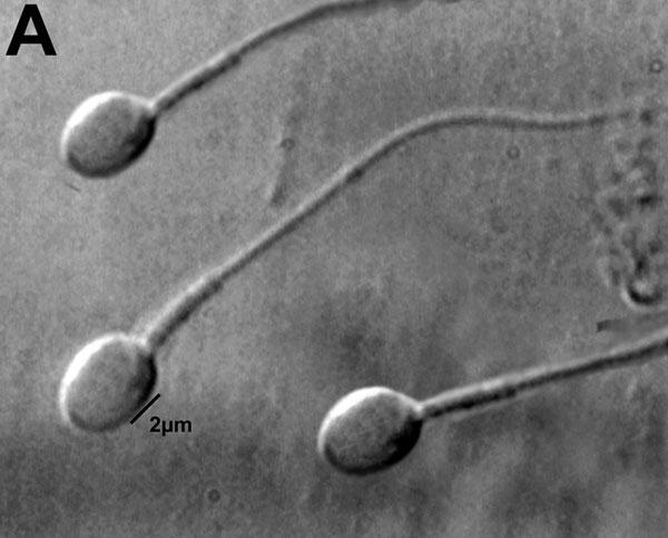 File:Human-spermatozoa 01b.jpg
