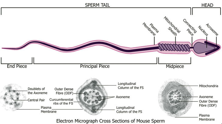 File:Mouse- spermatozoa EM and diagram.jpg