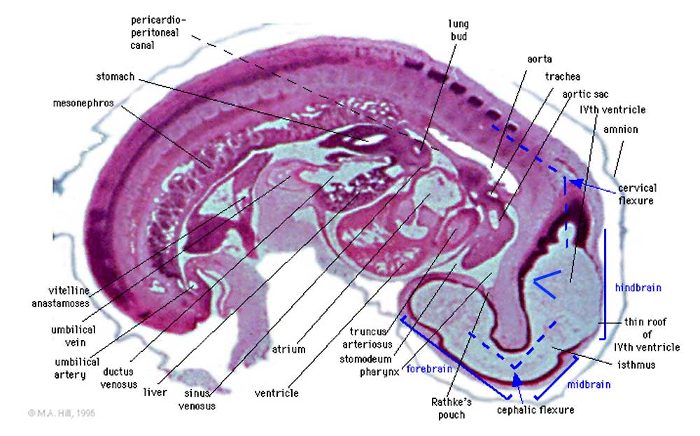 File:Embryo stage13- brain flexures.jpg - Embryology