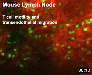 File:Mouse adult lymph node 01.jpg
