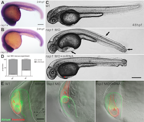 Abnormal heart and caudal fin development in zebrafish due to Rap 1 knock down.png