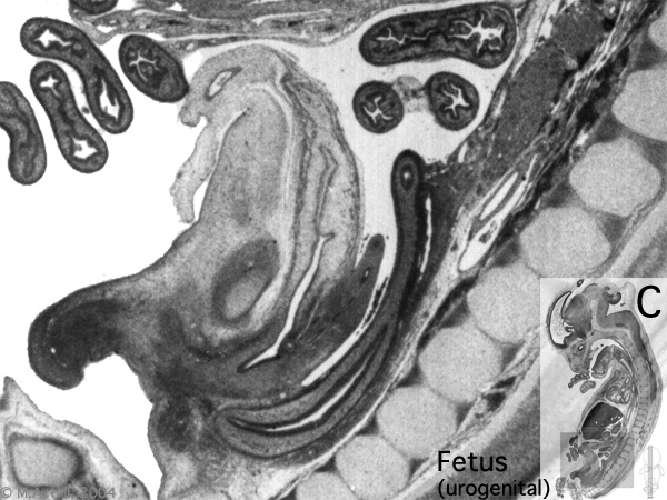 File:Human- fetal week 10 urogenital C.jpg