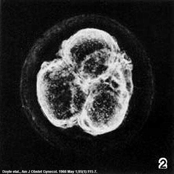 File:Human embryo 1966 day 2.jpg