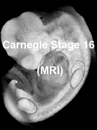 File:Stage16 MRI 3D01 icon.jpg