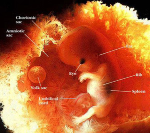 File:Embryo 11-14 weeks.jpg
