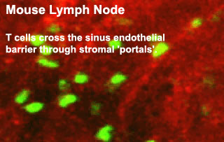 File:Mouse adult lymph node 06.jpg