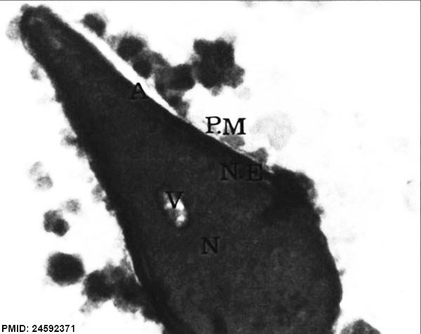 File:Human spermatozoa nucleus EM01.jpg