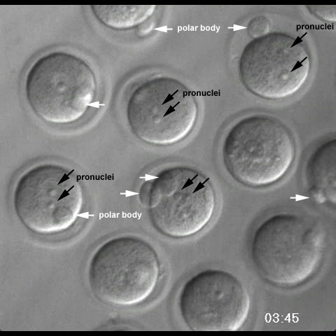 File:Mouse blastocyst movie pronuclei.jpg