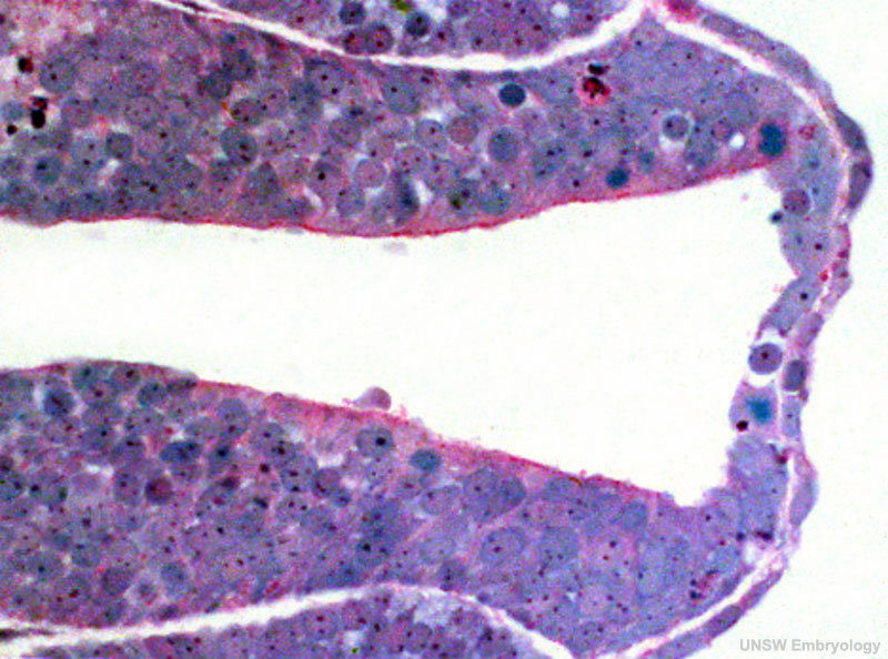 File:Stage11 histology-neural tube roof plate 1.jpg
