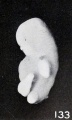 Fig. 133. Marked macerated and deformed fetus from the same case. X4.