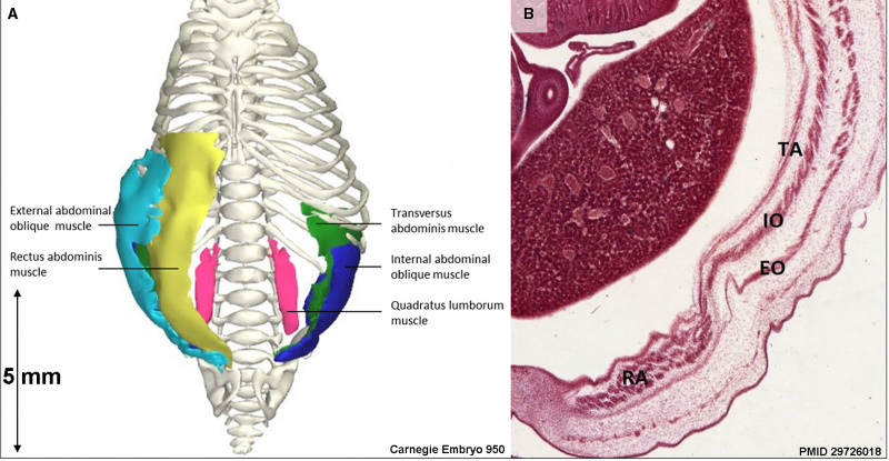 File:Carnegie stage 22 - pectoralis major muscle.jpg