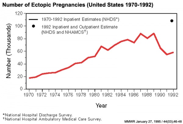 Ectopic Pregnancies- United-States 1970-1992.jpg