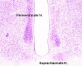 adult monkey hypothalamus depicting two major nuclei Existing website image.