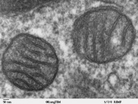 alt:Electron micrograph of mitochondria.