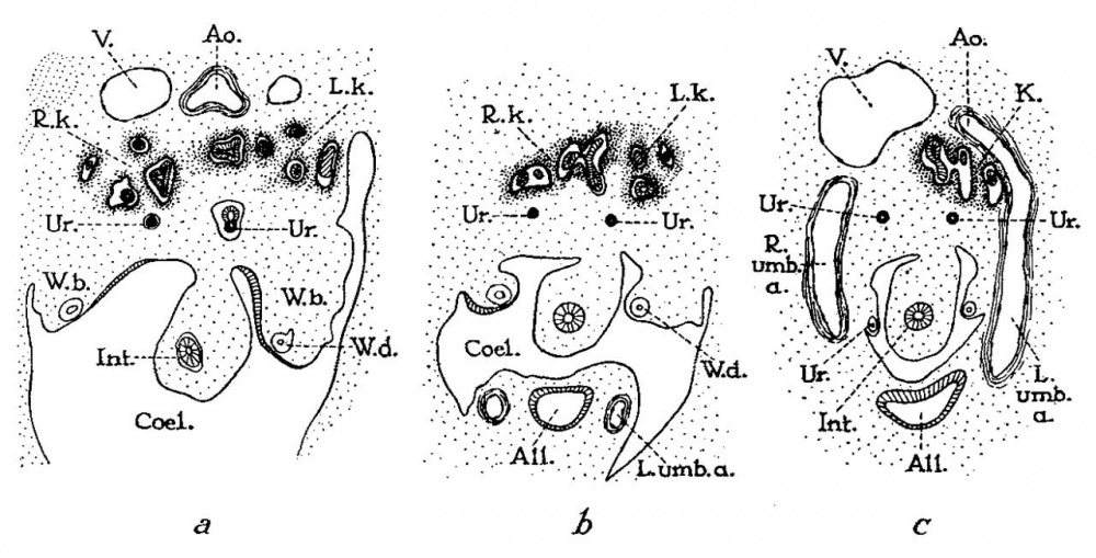Paper Description of a horseshoe kidney Embryology