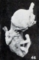 Figs. 42-50. Various forms of cyemata classed as fetus compressus: Nos. 1495c (X0.58).