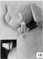 Fig. 18. Carnegie Embryo 1022d Male