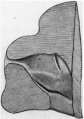 Fig 7. Lsteral wall of the nasal cavity