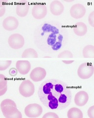 ANAT2241 Lymphatic Tissue and Immune System - Embryology