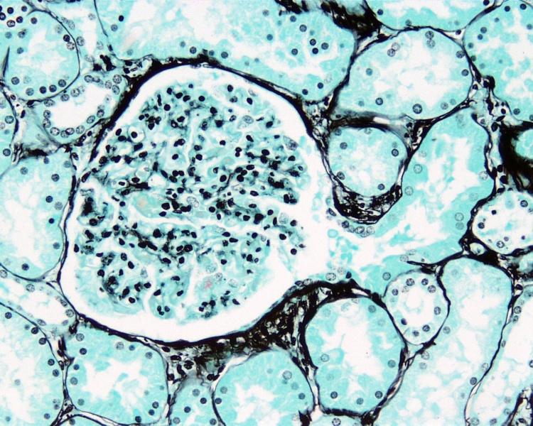 File:Renal histology 07.jpg