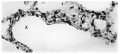 Fig. 16. alveoli term foetus