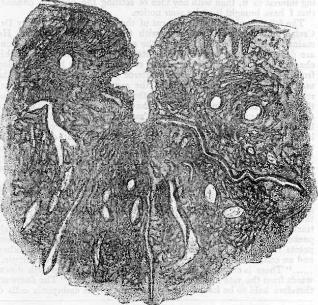 File:Bowlby1882 fig05.jpg