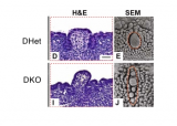 H&E histological and SEM images of WT and DKO mice