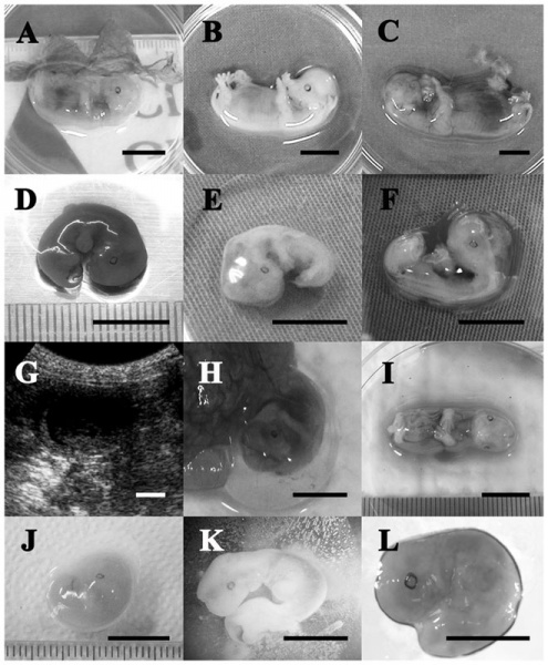 File:Control and parthenogenetic canine fetuses.jpg