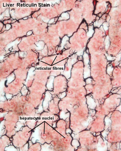 Liver-reticular fibre.jpg