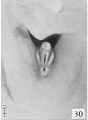Fig. 30. No. 22o0a, 40 mm., female. X 4.