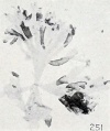 Fig. 251. Isolated shadow or gossamer villi. No. 2197. X9.