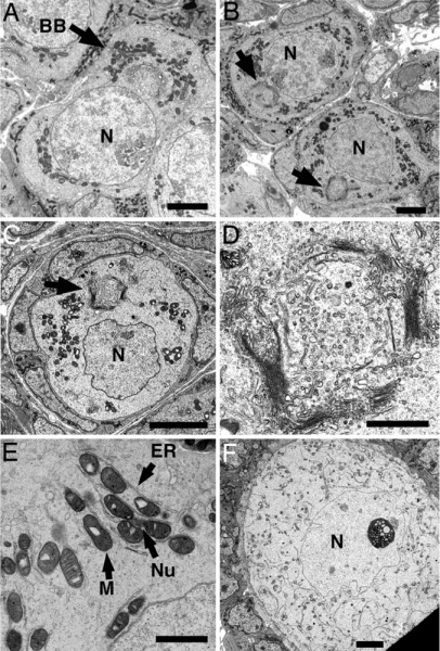 File:Mouse neonatal ovary oocyte EM01.jpg