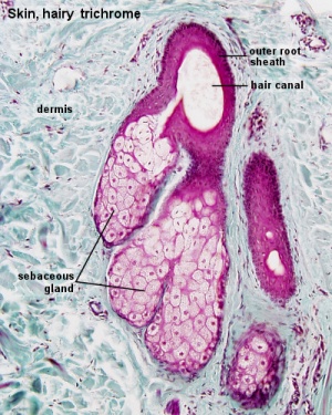 Adult skin sebaceous gland histology