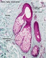 Sebaceous gland histology
